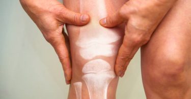 Best Vitamins for Cracking Knees