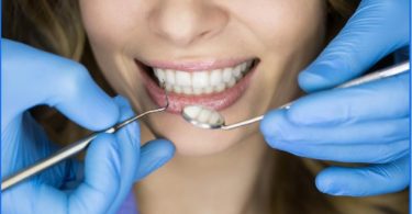 What to Know About Tooth Extraction Procedures